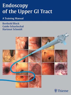 cover image of Endoscopy of the Upper GI Tract